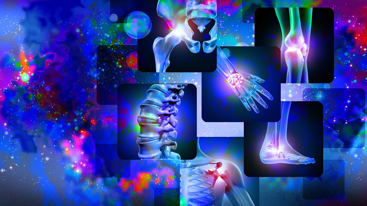 230403 Wdg Fibromyalgie 4