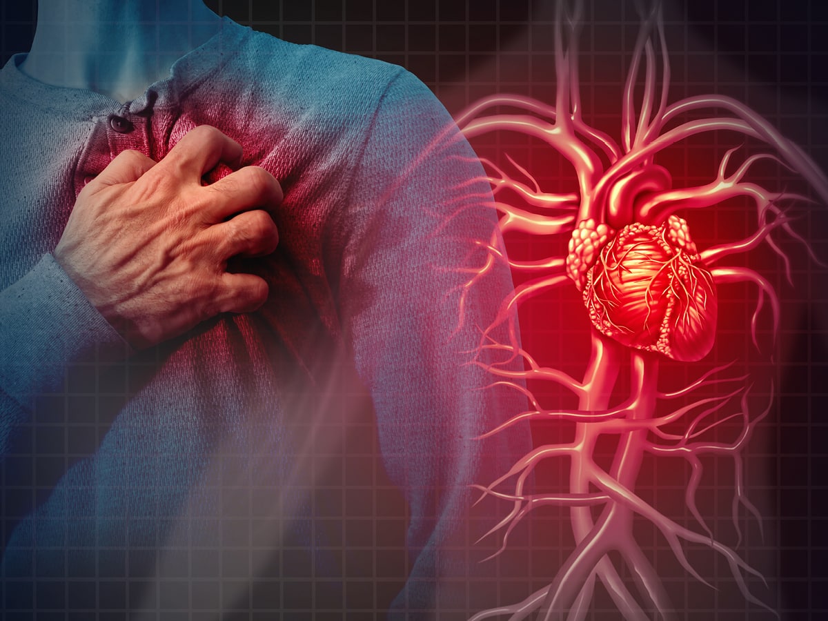 Wdg Herzkreislauf Vsl 12